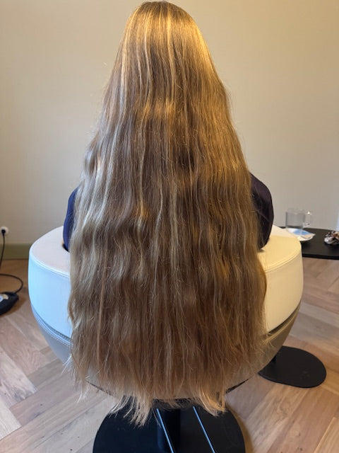 Haarverlies bij jongeren met coeliakie